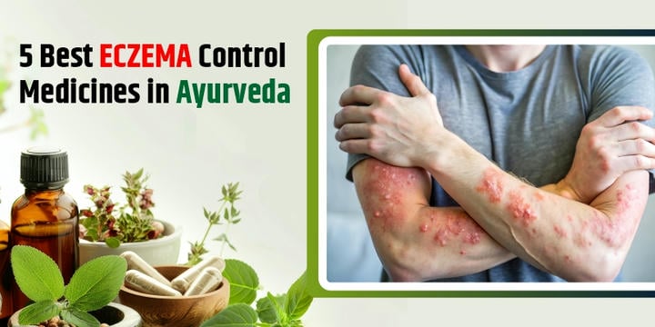 eczema-control-medicines-in-ayurveda